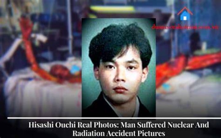 Unveiling The Mystery: Hisashi Ouchi's Real Photo Body