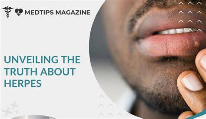 Unveiling The Truth About Sexy Redd And Herpes